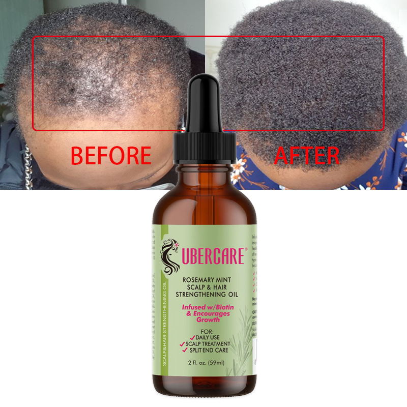 Hair Growth Serum